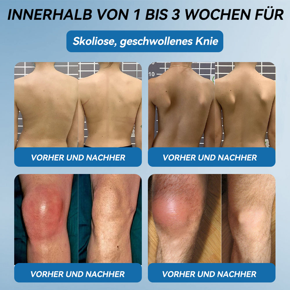 𝖯𝗂𝖼𝗱𝗼® BPC-157 Gelenkheilcreme🦴Behandelt Arthritis, Neuropathie, Rheuma, Sportverletzungen & mehr👍