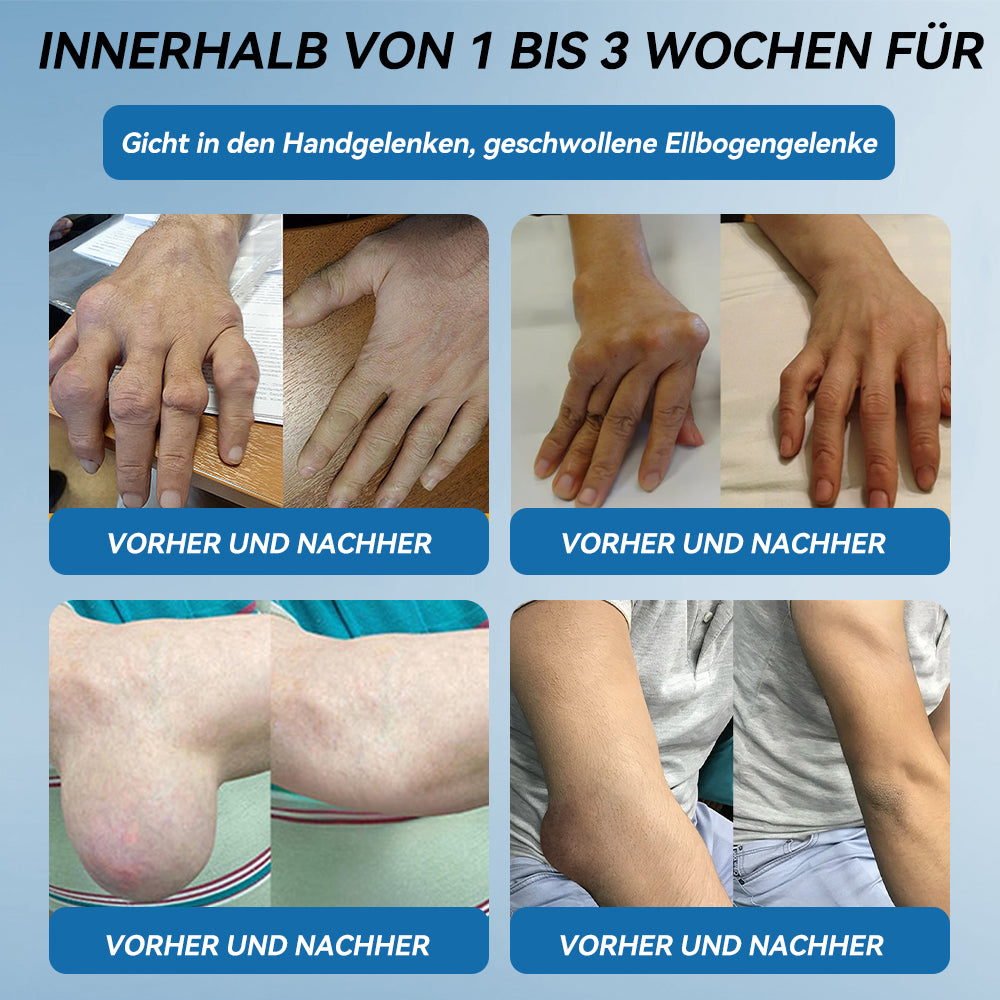𝖯𝗂𝖼𝗱𝗼® BPC-157 Gelenkheilcreme🦴Behandelt Arthritis, Neuropathie, Rheuma, Sportverletzungen & mehr👍