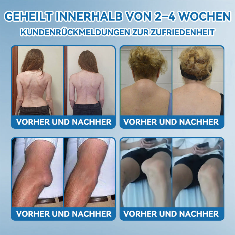 𝖯𝗂𝖼𝗱𝗼® BPC-157 Gelenkheilcreme🦴Behandelt Arthritis, Neuropathie, Rheuma, Sportverletzungen & mehr🦵