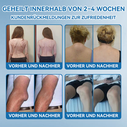 𝖯𝗂𝖼𝗱𝗼® BPC-157 Gelenkheilcreme🦴Behandelt Arthritis, Neuropathie, Rheuma, Sportverletzungen & mehr🦵