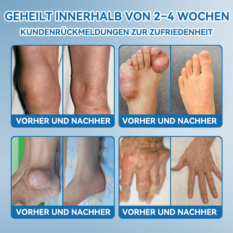 𝖯𝗂𝖼𝗱𝗼® BPC-157 Gelenkheilcreme🦴Behandelt Arthritis, Neuropathie, Rheuma, Sportverletzungen & mehr🦵